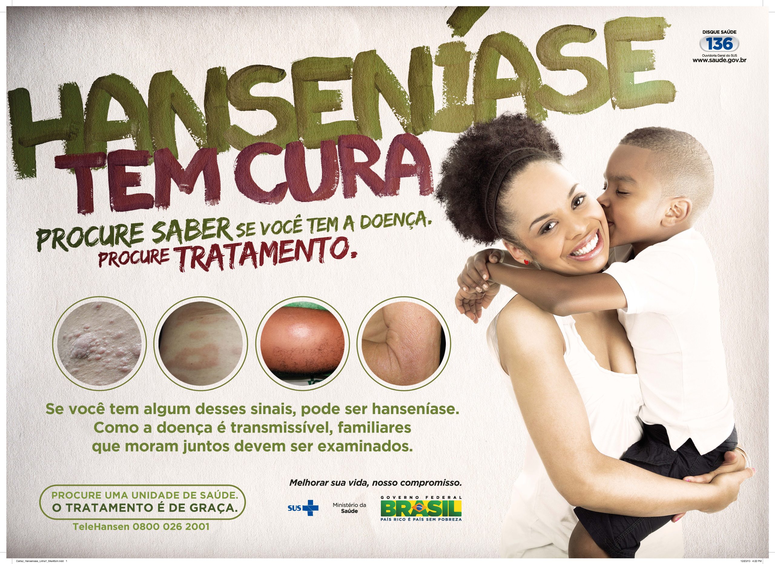 Dia D de combate à Hanseníase e à Tuberculose será no próximo dia 27